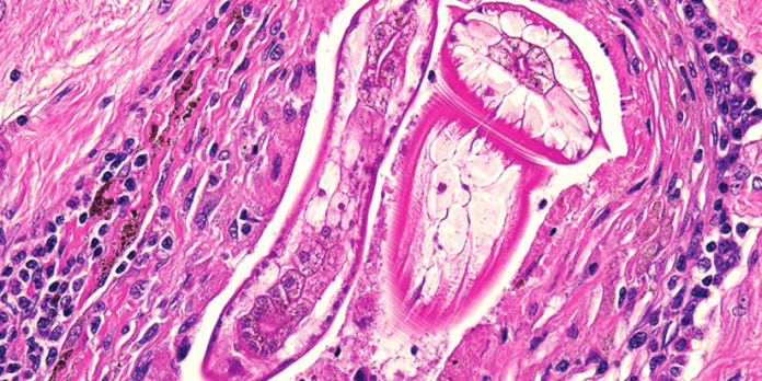 Toxocariasis - කොරෝනා අස්සේ දරුවන් අතර පූසන්ගෙන් හා බලු පැටවුන්ගෙන් බෝ වන පණු රෝගයකුත් පැතිරෙයි