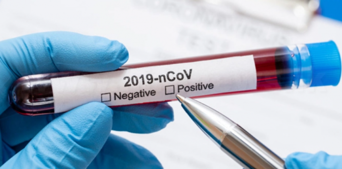 Covid Positive Cases - අද මේ දක්වා කොරෝනා වෛරස් ආසාදිතයින් 816ක්