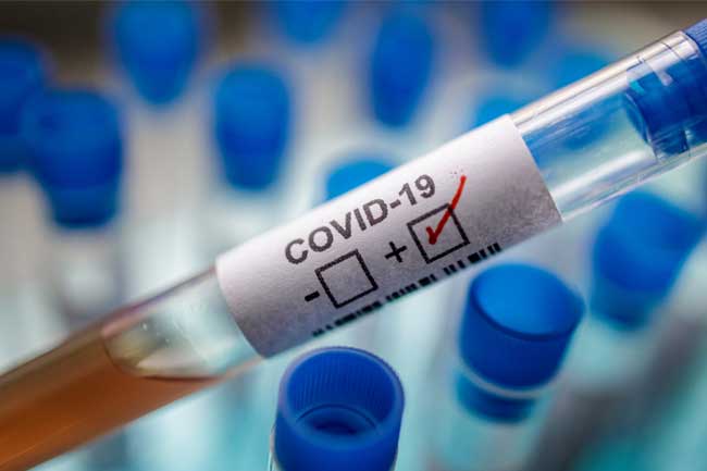 Covid Positive Cases Today - අද කොවිඩ් වෛරසය ආසාදිතයින් 1488ක්